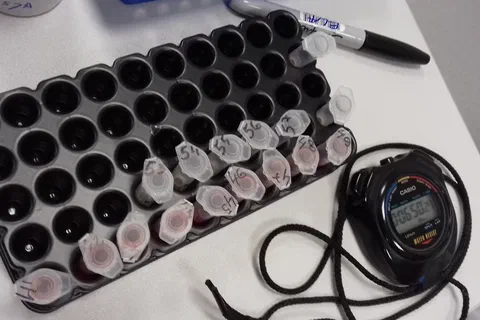 Statyw laboratoryjny z ponumerowanymi probówkami typu Eppendorf, stoperem i markerem na blacie.